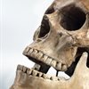 Scientists solve the 800 year old mystery of an ancient bone disease
