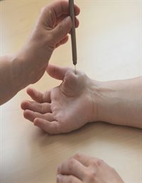 A needle being placed into the palm of a hand