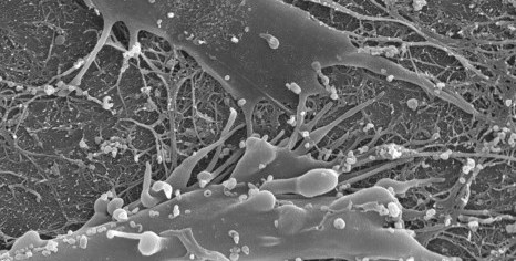 SEM-Image Cells on Amniotic Membrane
