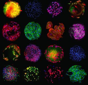 Cell Polymer Microarray (Asha Patel, 2015),