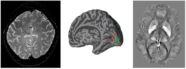 High resolution anatomical and functional brain images produced on the 7T scanner