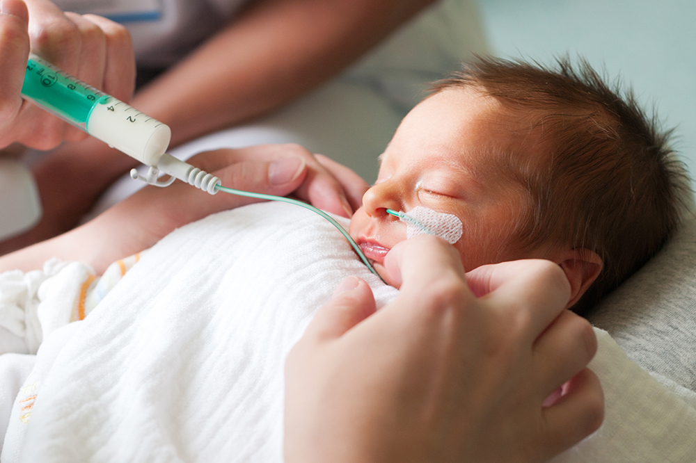 A young baby being fed by a drip