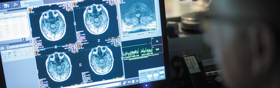 Academic looking at brain scans