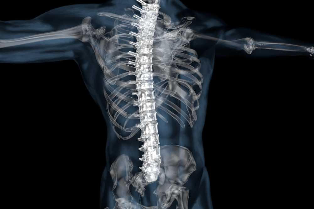 3D xray of torso and upper arms