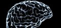 Brain scans could predict response to antipsychotic medication