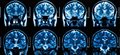 MRI technology to offer most detailed insight into how the brain controls our sense of touch