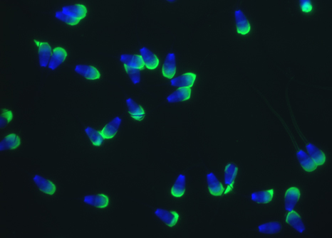 Bovine spermatozoa fluorescently labelled with two dyes