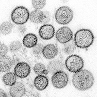 Transmission electron micrograph of Sin Nombre virus courtesy of CDC/ Cynthia Goldsmith, Luanne Elliott