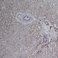 Immunochemical staining of rabbit haemorrhagic disease virus in liver tissue