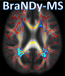 BraNDy-MS-208