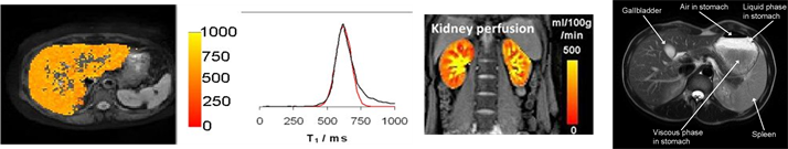 Examples of (left to right) liver relaxometry, kidney perfusion and imaging of food materials in the stomach