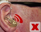 What should I do if my hearing aids whistle (feedback)?