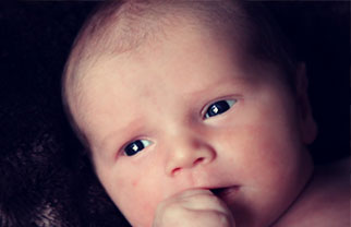 Birth trauma linked image of Baby's head