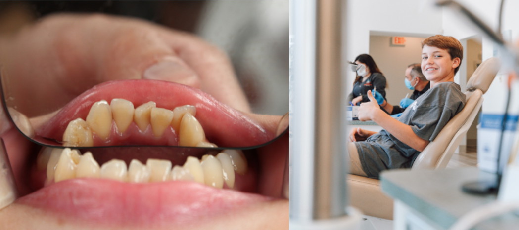 A picture of patient with gum disease and another of a boy in dentist chair with thumbs up.